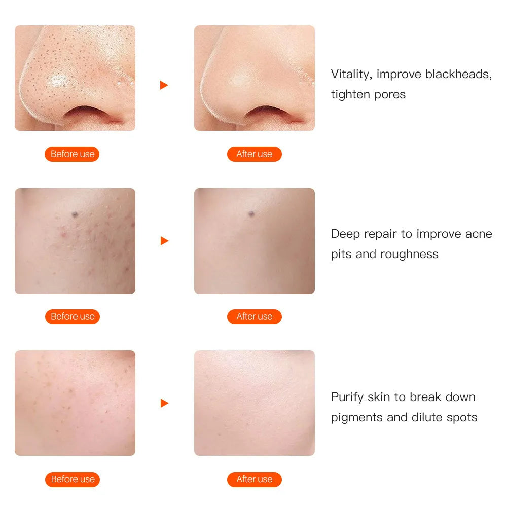 Auréal Pro LED Therapy Mask